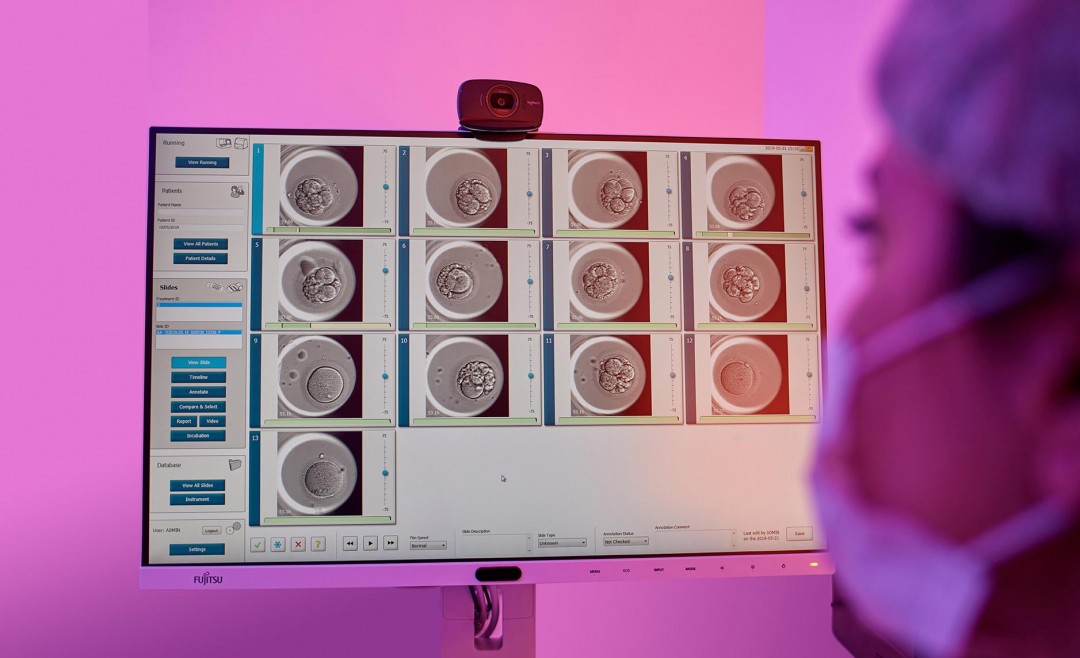 Эмбриоскоп. Эко процедура. Embryoscope time-lapse System. Эмбриоскоп фото.
